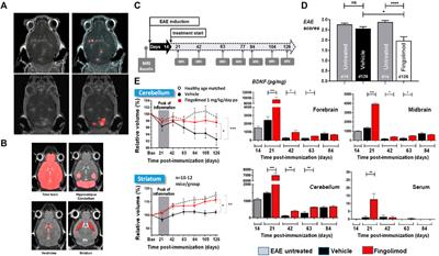 Magnetic resonance imaging and ultrasound elastography in the context of preclinical pharmacological research: significance for the 3R principles